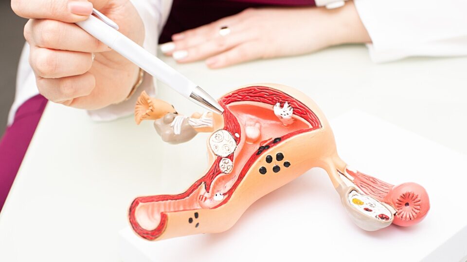 Лучшие методы лечения рака яичников