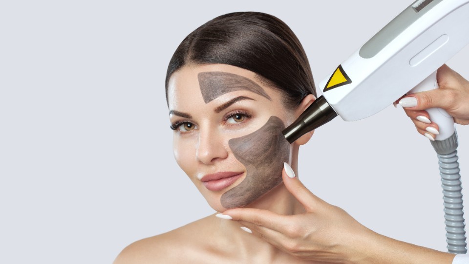 Карбоновый пилинг лица